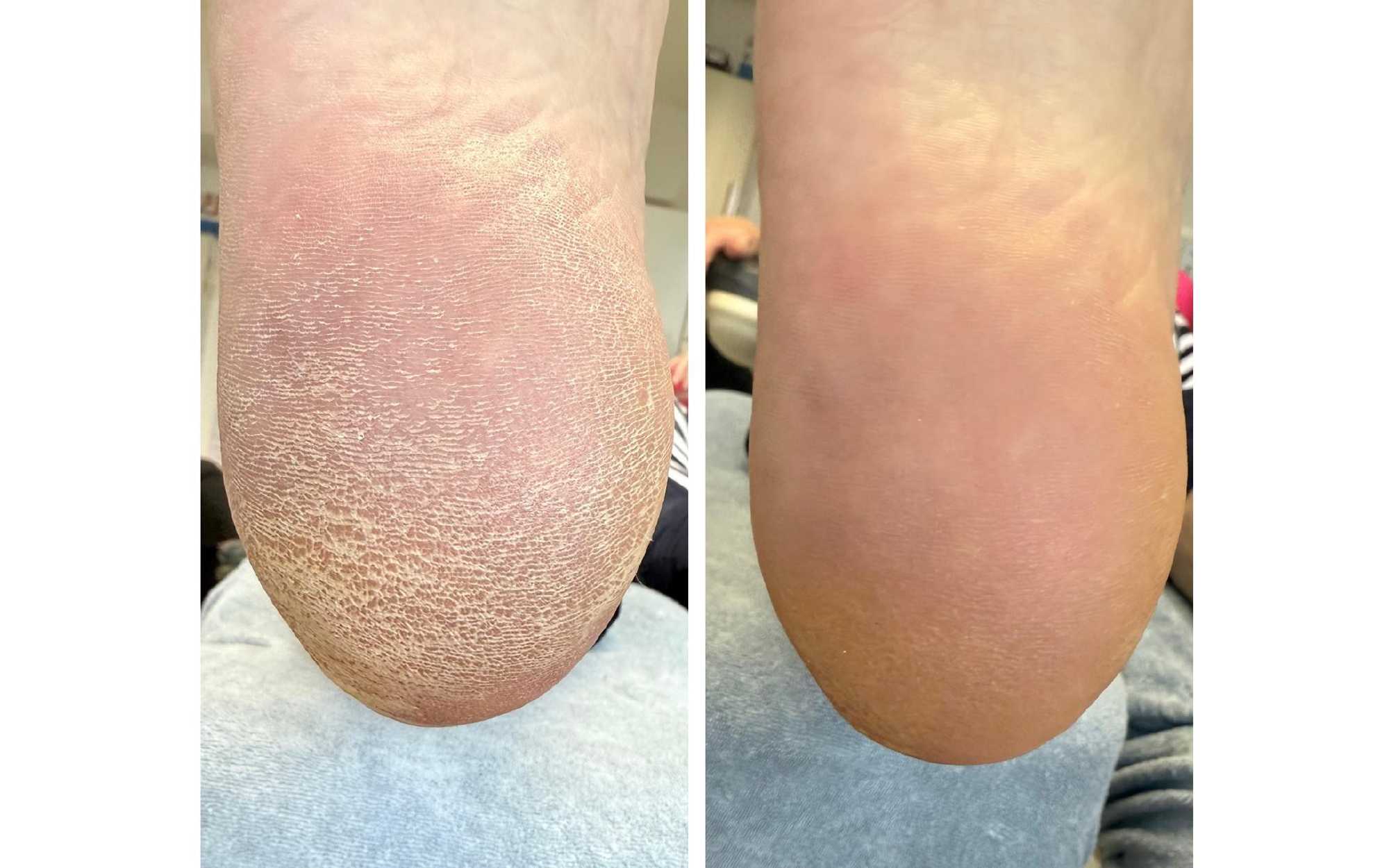 Before / After